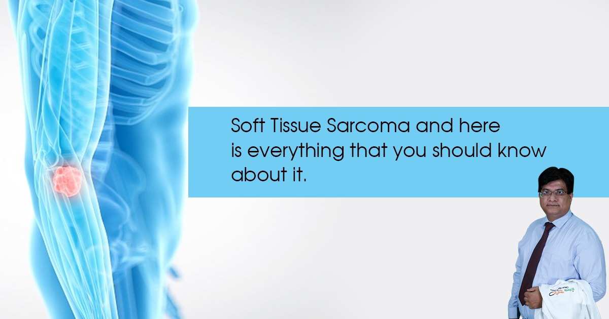 Soft Tissue Sarcoma and here is everything that you should know about it.